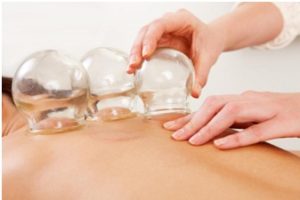 Acupuncture Cupping