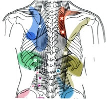 Trigger Points For Back / Shoulder Pain